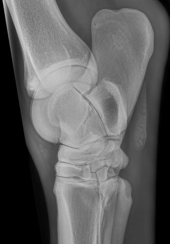 Scanner-jarret-breviaires